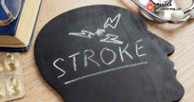 Wanita di Jawa Mendadak Berlogat Asing Usai Stroke, Dokter Ungkap Fenomena Langka Sindrom Logat Asing